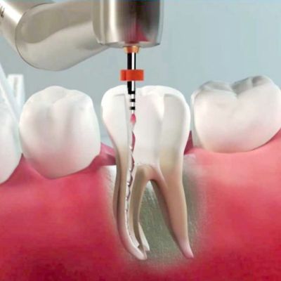 Endodonzia