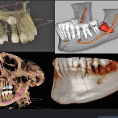 Radiologia computerizzata odontoiatrica